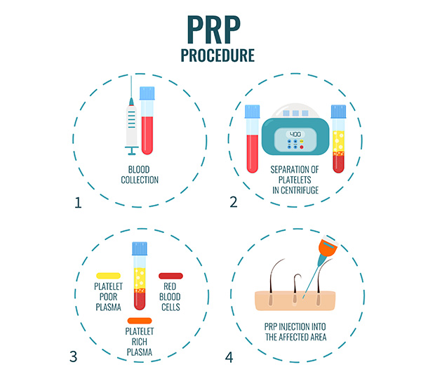 Ooltewah PRP Treatment